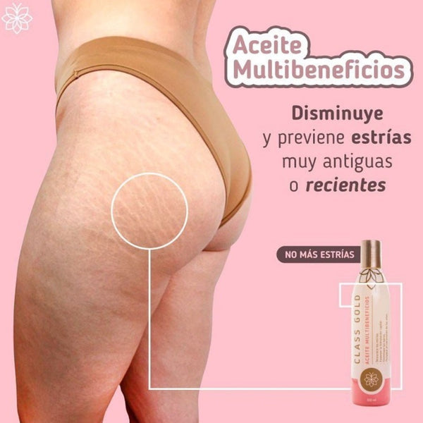 Stretch Marks Multi-benefit Oil 120ML