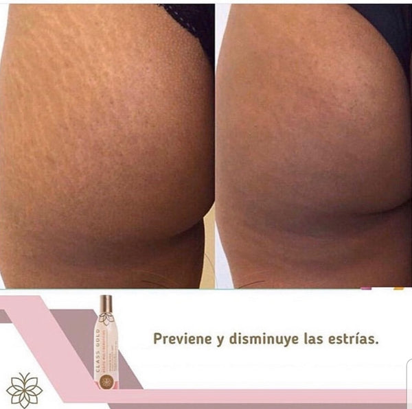 Stretch Marks Multi-benefit Oil 120ML