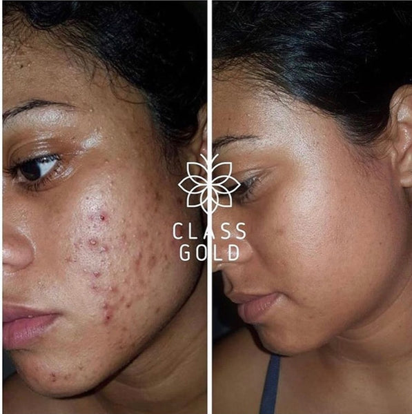 Facial tonic 25ML